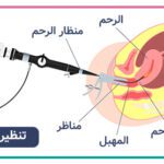 منظار الرحم قبل الحقن المجهري : الأهمية والاستخدام