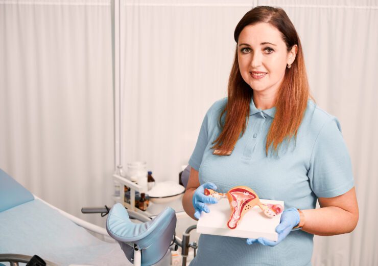 Charming female doctor holding uterus anatomy model.