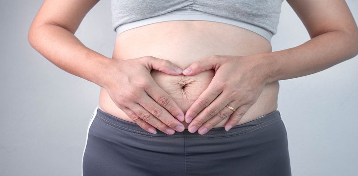 6 أسباب لكبر حجم البطن بعد الولادة القيصرية